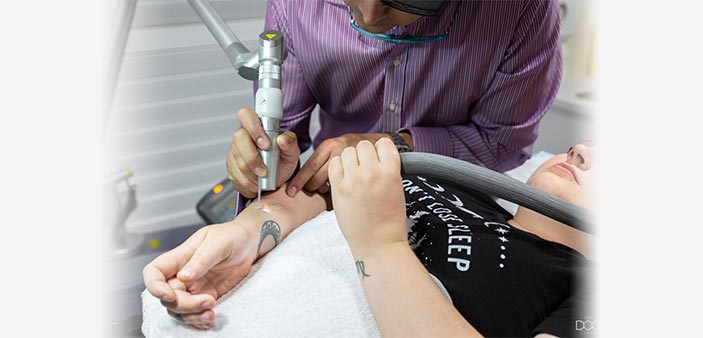 Tattoo Removal - 7