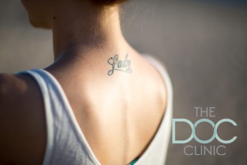 RevLite Laser tattoo removal, model 01, featured image