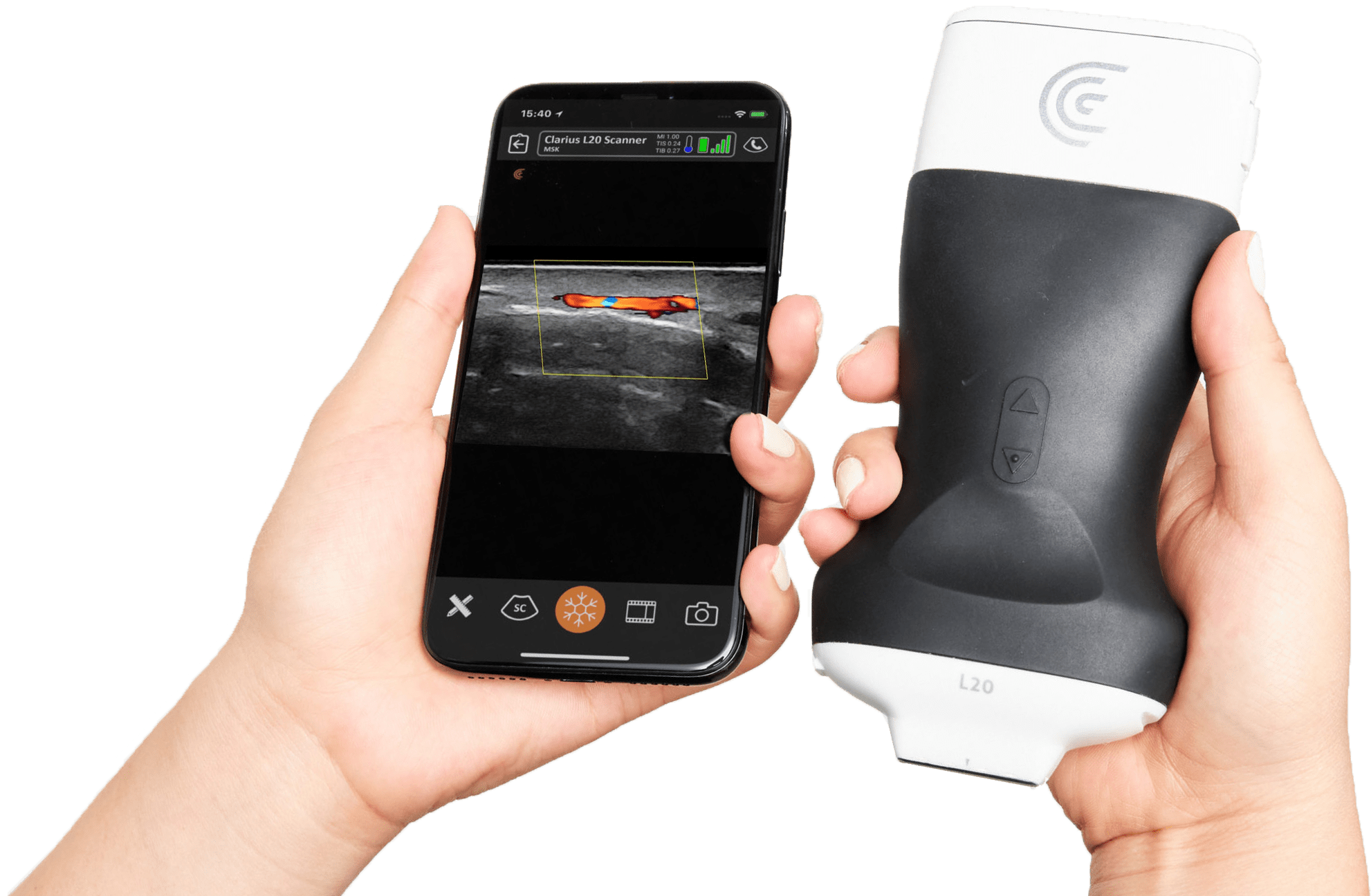 Clarius LD20 Facial Ultrasound Scanner - 2